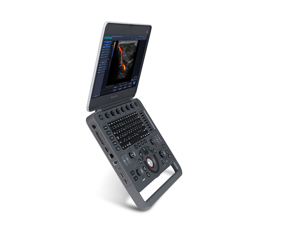 SonoScape X5 ultrasound unit